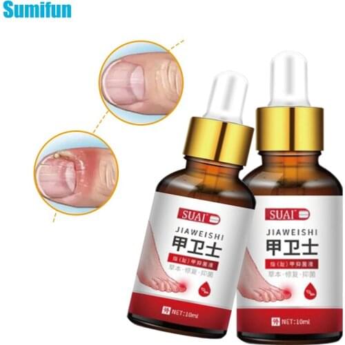 10ml Onychomycosis Treatment Oil Fungal Nail Repair Essence Serum Herbal Fungus Removal Gel Anti Infection Paronychia Foot Care