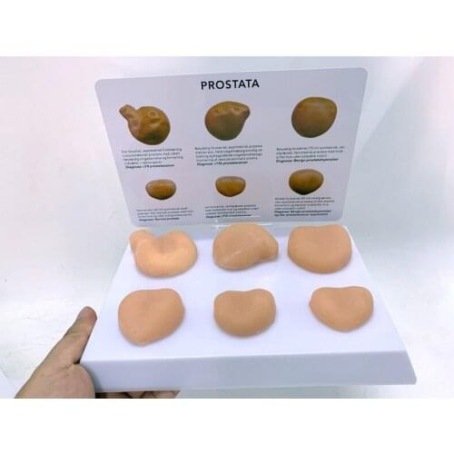 Male Prostate Model Genital Anatomy Male Pelvic Sagittal Section Teaching Model