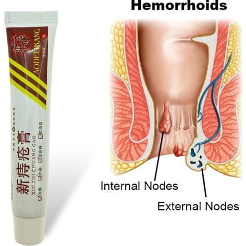 1PC Powerful Hemorrhoids Ointment Crack Anal Chinese Cream Internal External Anal Fissure Herbal Medical Plaster QE54S