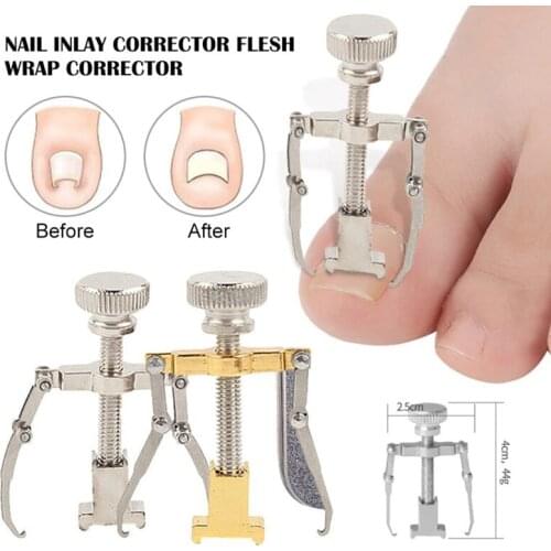 Ingrown Toenails Correction Tool Foot Toe Nail Care Tools Straightening Clip Brace Corrector Feet Pedicure Treatment Adjuster