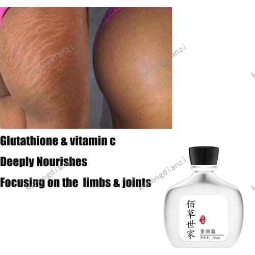 180ml Stretch Marks Remover Stretch Marks Reversal Cream Stretch Marks Remover Shipping Cream Pregnant Woman Drop Skin Care