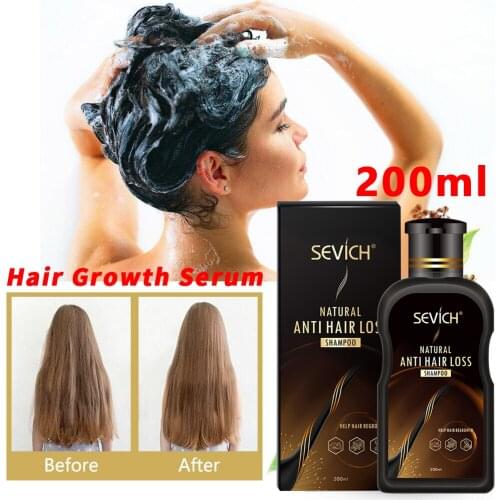 200ml Hair Care Product Ginger Anti Hair Loss Hair Growth Serum Shampoo Effective Hair Loss Treatment Cool Hair Growth Liquid
