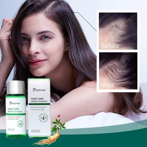 PUTIMI Natural Ginger Anti Hair Loss Hair Growth Fast Essential Oil for Men Women Hair Regeneration Repair Dense Treatment 20ml