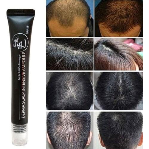 Hair Growth Serum Anti Hair Loss Care Products Grow Serum Women Regrowth Maintenance Treatment Enhancer Men Hair Oil Growth M3G0