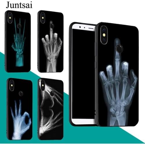 X-ray Hand Bones Case For Redmi Note 9 Pro 9S 8T 8 Pro 9A 9C For Mi 9 9T Note 10 Lite For POCO X3 Couqe
