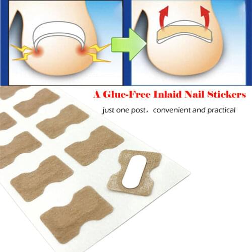 50PCS Pedicure Ingrown Nail Tools Toenail Stickers Nails Corrector Paronychia Treatment Fixer Recover Bunion Pedicura Feet Care