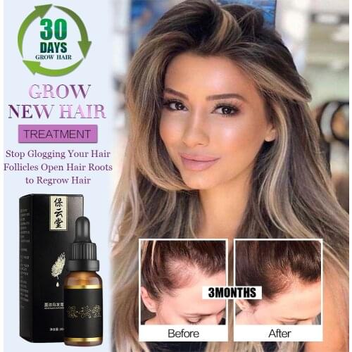 Anti Hair Loss Products Hair Care Essential Oils That Promote Fast Hair Growth of Hair Natural Health Extract Hair Restorer