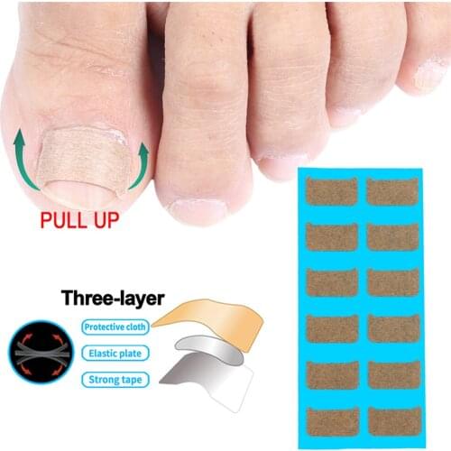 36pcs Ingrown Toenail Correction Stickers Nail Corrector Patches Paronychia Treatment Recover Sticker Pedicure Foot Care Tools