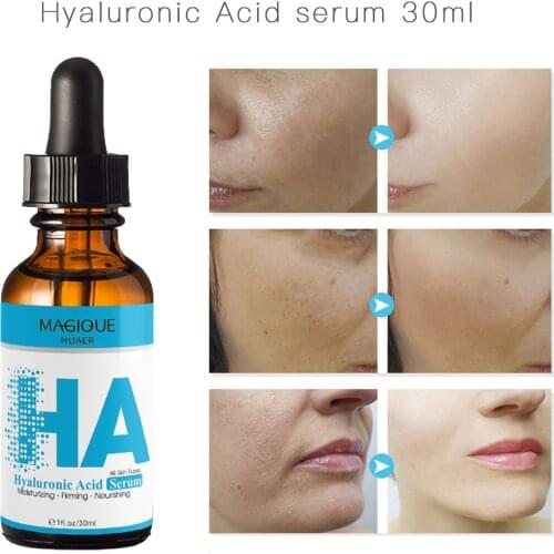 Hyaluronic Acid Face Serum Whitening Brightening Acne Treatment Serum For Face Pore Minimizer Skin Repair Korean Facial Skincare