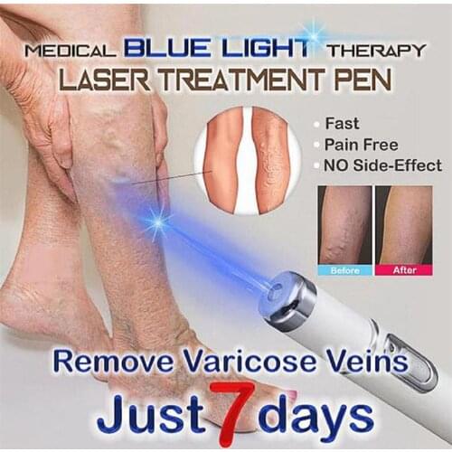 Heath Blue Light Therapy Varicose Veins Treatment Laser Pen Soft Scar Wrinkle Removal Treatment Acne Laser Pen Massage Relax