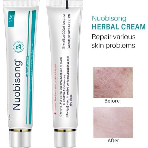 1PC Scar Stretch Marks Removal Acne Treatment Nuobisong Face Skin Care Treatment Face Pimples Whitening Moisturizing Cream