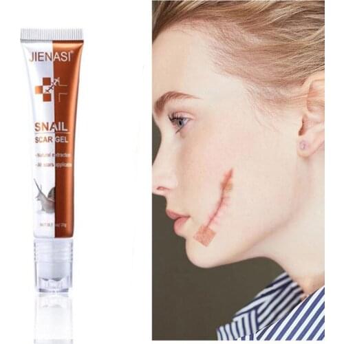 20G Snail Scar Removal Serum Acne Scar Removal Gel Fade Stretch Mark Surgical Scar Repair Scar Wound Smooth Skin Scar Care