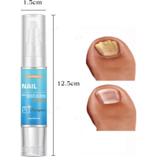 4ML Nail Fungus Treatment / Onychomycosis Paronychia / Anti Fungal Nail Infection Toe Nail Treatment Pen