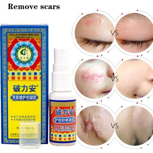 Acne Scar Removal Cream Pregnancy Removal Gel Whitening Scald Treatment Scars Postoperative Repair Ointment Body Skin Care 1pcs