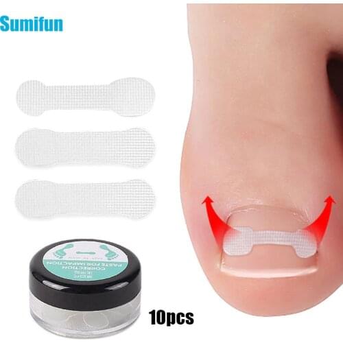 10pc/box Ingrown Toenail Correction Tool Straightening Clip Brace Ingrown Toe Nail Treatment Elastic Patch Sticker Pedicure Tool