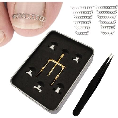 Ingrown Toenail Treatment Kit Corrector Fixer Recover Toe Nail Lifter Clamp Tweezer Wire Foot Pedicure Tool for Paronychia