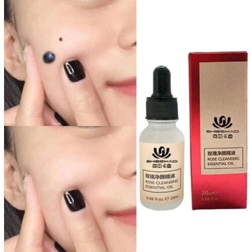 20ml Organic Tags Solutions Serum Skin Tag Remover Serum Organic Skin Tag Remover Serum Face Wart Tag Mole Freckle Spot Painless
