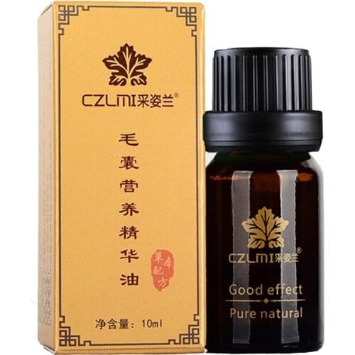 10ml Powerful Hair Care Hair Growth Essential Oil treatment Anti-hair loss Liquid Products Beauty Dense Hairs Growth Essence