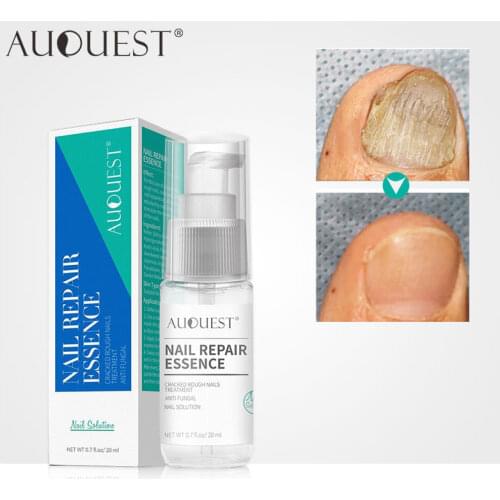 AUQUEST Fungal Nail Treatment Serum Feet Care Essence Anti Infection Paronychia Onychomycosis Nail Fungus Removal Gel 20ml