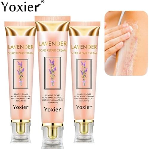 Yoxier Repair Scar Cream Acne Scar Stretch Marks Pigmentation Corrector Anti-allergic Calm Whitening Skin Care Face Cream 3pcs