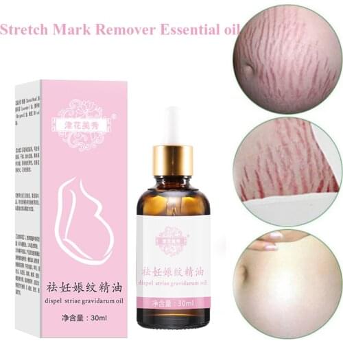 Stretch Marks Remover Essential Oil Skin Care Treatment Cream For Stretch Mark Removal Maternity Slackline For Pregnant Oils