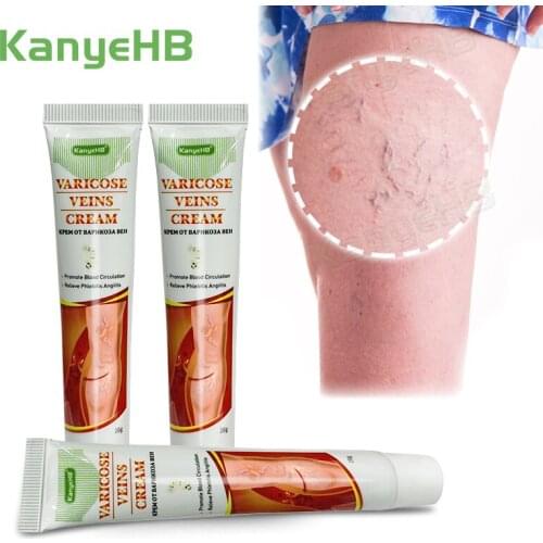 3pcs KanyeHB New Arrivals Varicose Veins Treatment Cream Vasculitis Phlebitis Medical Ointment Varicosity Herbal Plaster A641