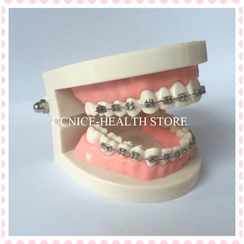 2Times Orthdontic teeth model Brushing demonstration to patients with orthodontic restoration/Dental Orthodontic Teaching Model