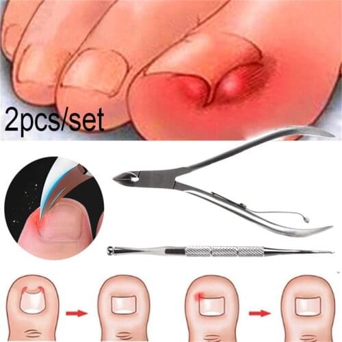 2pcs Ingrown Finger Toe Nail Correction Nippers Nail Clipper Cutters Dead Skin Dirt Remover Paronychia Podiatry Pedicure Tools