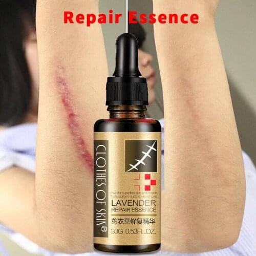 Essential Massage Oil Scar Removal Lavender Repair Essence For Pregnant Women Hyaluronic Acid Serum Oil Essential Face Anti Acne