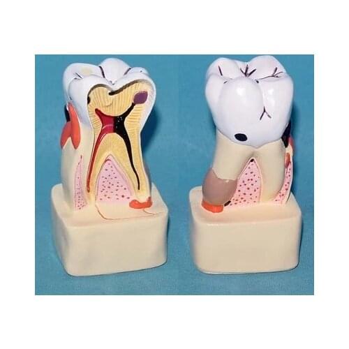 Human Teeth Anatomical Model pathology Oral Care Medical Teaching free shipping