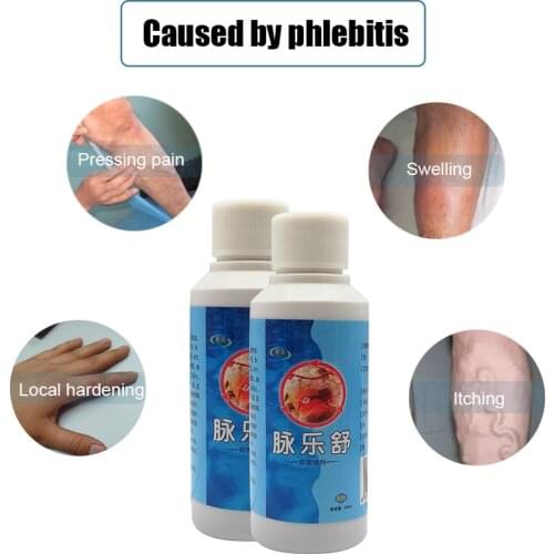 Varicose Veins Spray Skin Care Restore Level Treatment for Relief Phlebitis Angiitis Meridian Smoothing