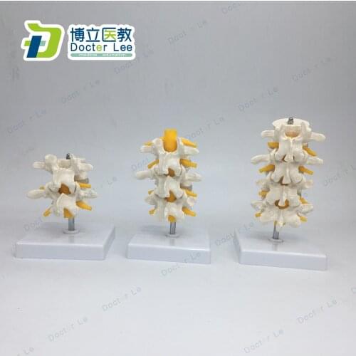 The Lumbar Vertebrae Model 2-4 Section Lumbar Vertebraes with Spinal Nerves Anatomical Model Life Size