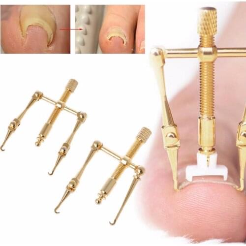 Professional 100% copper Ingrown Toenails foot Toe nail Correction Tool Manicure Clipper Pedicure Fixer file Recover for feet
