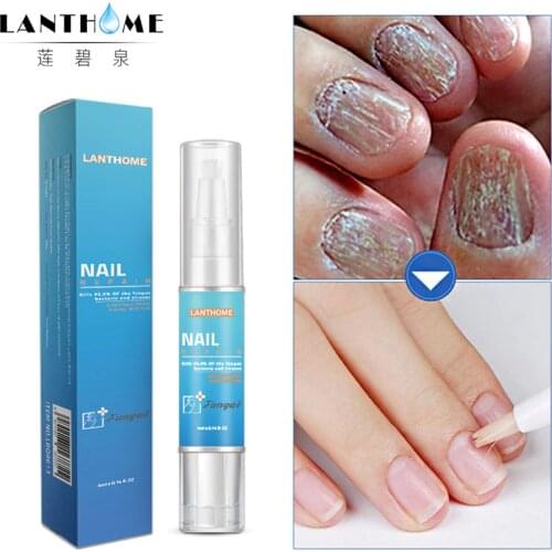 4ML Nail Repair Treatment Liquid Fungus Remover Protective Nail Pen Brush Nail Nourishing Brightening Hand Foot Care TSLM2