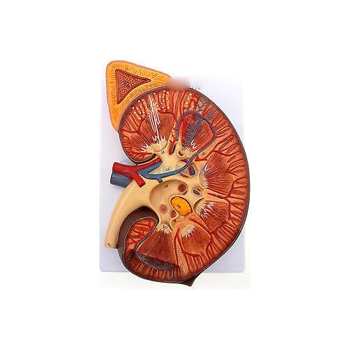 3 Times Enlarged Human Kidney Anatomical Medical Model With Adrenal Glands for Patient Education