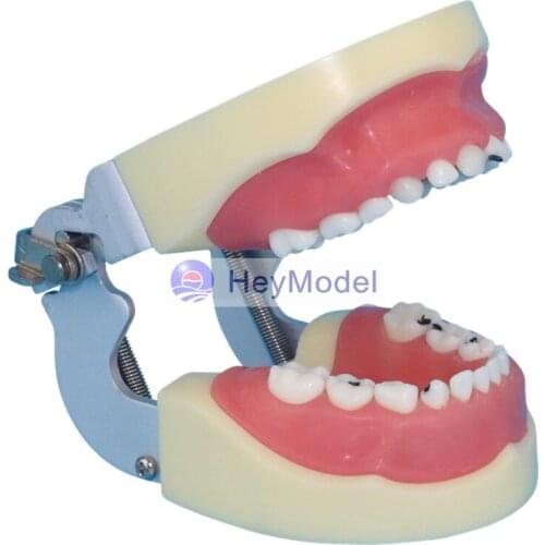 HeyModel Children Caries Model