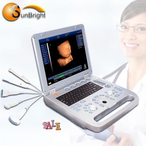 SUN-800D laptop 3d charger ultrasound fetal doppler machine ultrasound /portable ultrasound for pregnancy