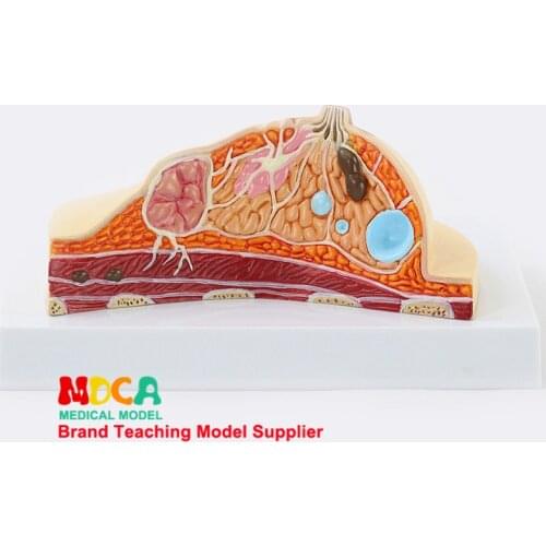 Breast pathology breast anatomy model breast augmentation beauty model gynecological model medical teaching MRF003
