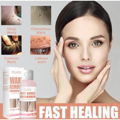 EELHOE 30g Skin Tags Warts Remover Cream Face Body Tag Remover Foot Corn Warts Ointment Antibacterial Plaster Skin Beauty Care