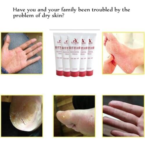 Heel Chapped Peeling Foot Free Shipping Hand Repair Anti Dry Cracked Ointment Cream Skin Repair Moisturizing Foot Cream