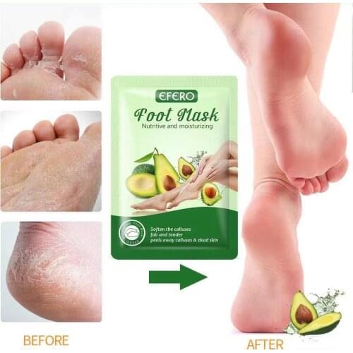 Avocado Exfoliating Foot Mask Scrub Exfoliation Pedicure Socks Feet Patch Remove Dead Skin Heels Feet Peeling Mask Foot Spa