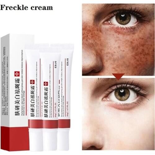 3PCS Effective Whitening Freckle Cream Remove Dark Spots Anti Freckle Cream Fade Pigmentation Melasma Brighten Creams Skin Care