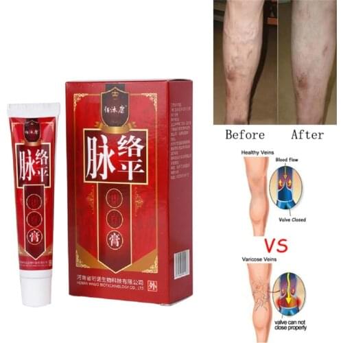 1pc Varicose Veins Treatment Cream Foot Cream Ointment Vasculitis Phlebitis Pain Angiitis Remedy Removal Cream Maquiagem