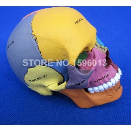 Advanced Dispersive Skull Bone model,Human Color assembled skull model,Human Skull Fragment model