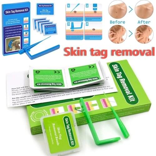 Face Care Mole Wart Tool Skin Tag Remover Kit For Small To Medium Blue Skin Tag Mole wart Remover Micro Band With Cleansing Swab