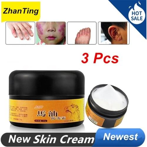 ZhanTing 3 Pcs Frostbite Chinese Medicinal Hand Foot Cream Heel Chapped Peeling Repair Frostbite Anti Dry Crack Skin Creams