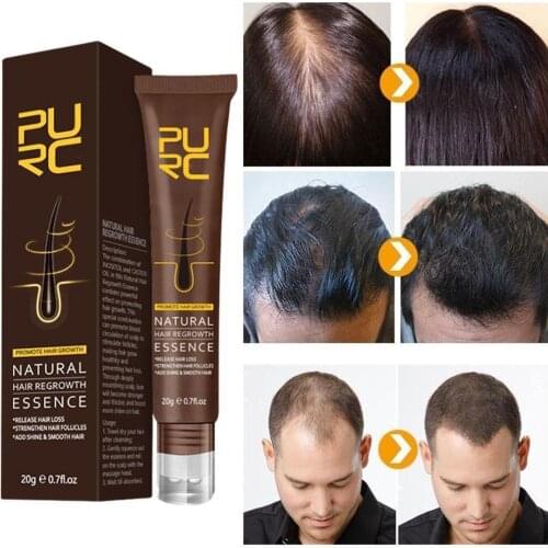 20g Hair Growth Lotion Anti Hair Loss Nourishing Hair Root Dense Hair Increasing Lotion Hair Serum Hair Growth Gel