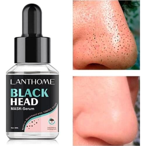30ml Blackhead Remover Serum Moisturizing Oil Control Whitening Shrinks Pores Deep Cleansing Pores Face Cleaning Essence