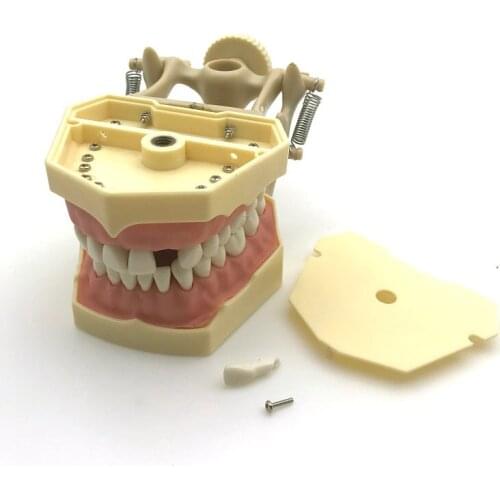 1 Piece SF Type Dental Teeth Study Model Screw Fixed Teeth Model, Soft Gum & DP