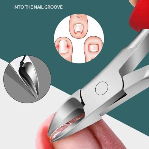 Huiyun Nail Clippers Ingrown Toenail Nippers Cuticle Cutters Manicure Tool Anti-Splash Paronychia Correction Manicure Stainless